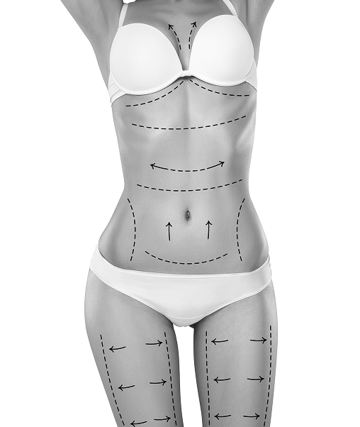 شفط الدهون 360 درجة في دبي د.ماريو روسو