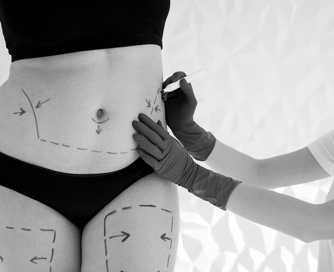 مامي ميك اوفر في دبي د.ماريو روسو | Mommy Makeover in Dubai Dr. Mario Russo