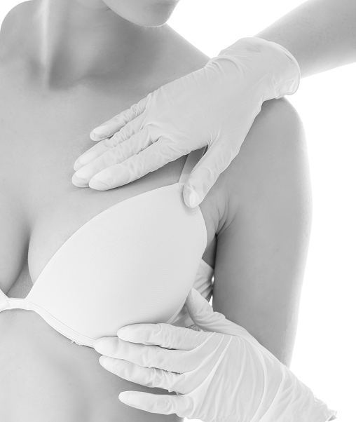 Breast and Areola Reconstruction surgery candidate