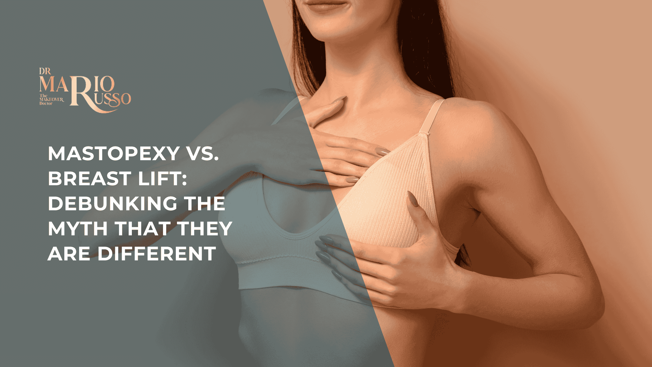 Mastopexy vs. Breast Lift Debunking the Myth That They Are Different